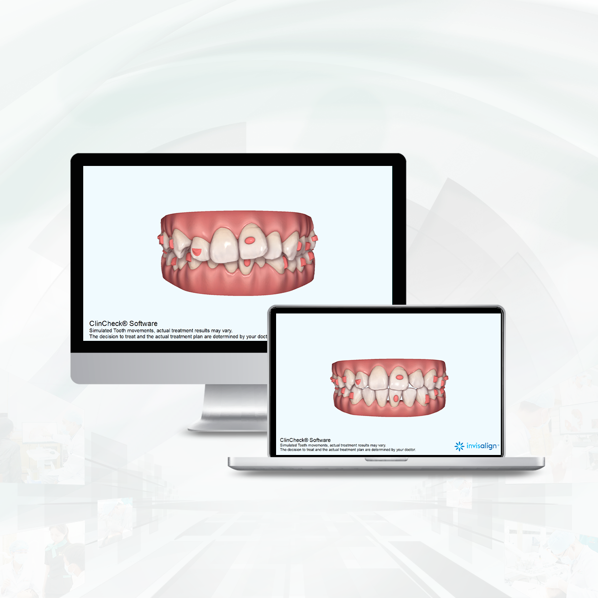 ClinCheck iTero Element 5D