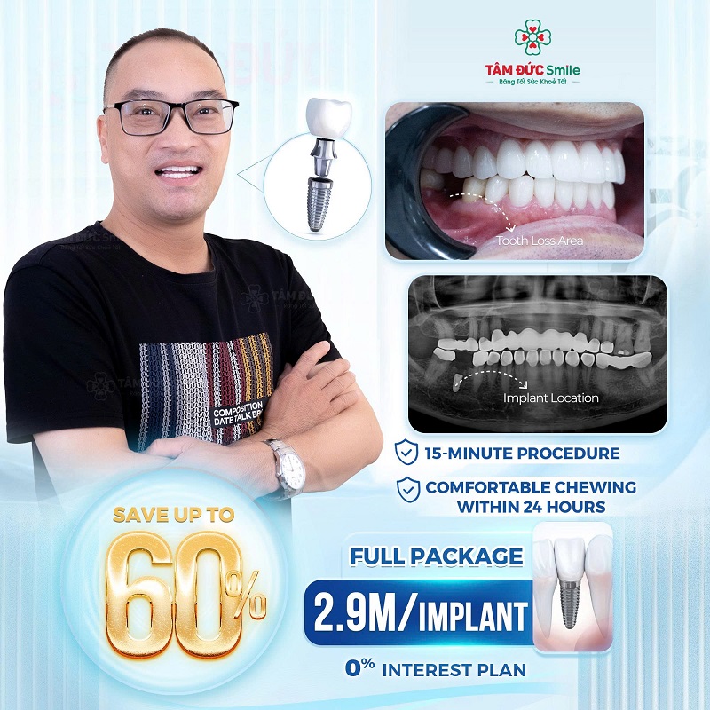 ALL-INCLUSIVE IMPLANT PACKAGE FROM ONLY ~$116 USD